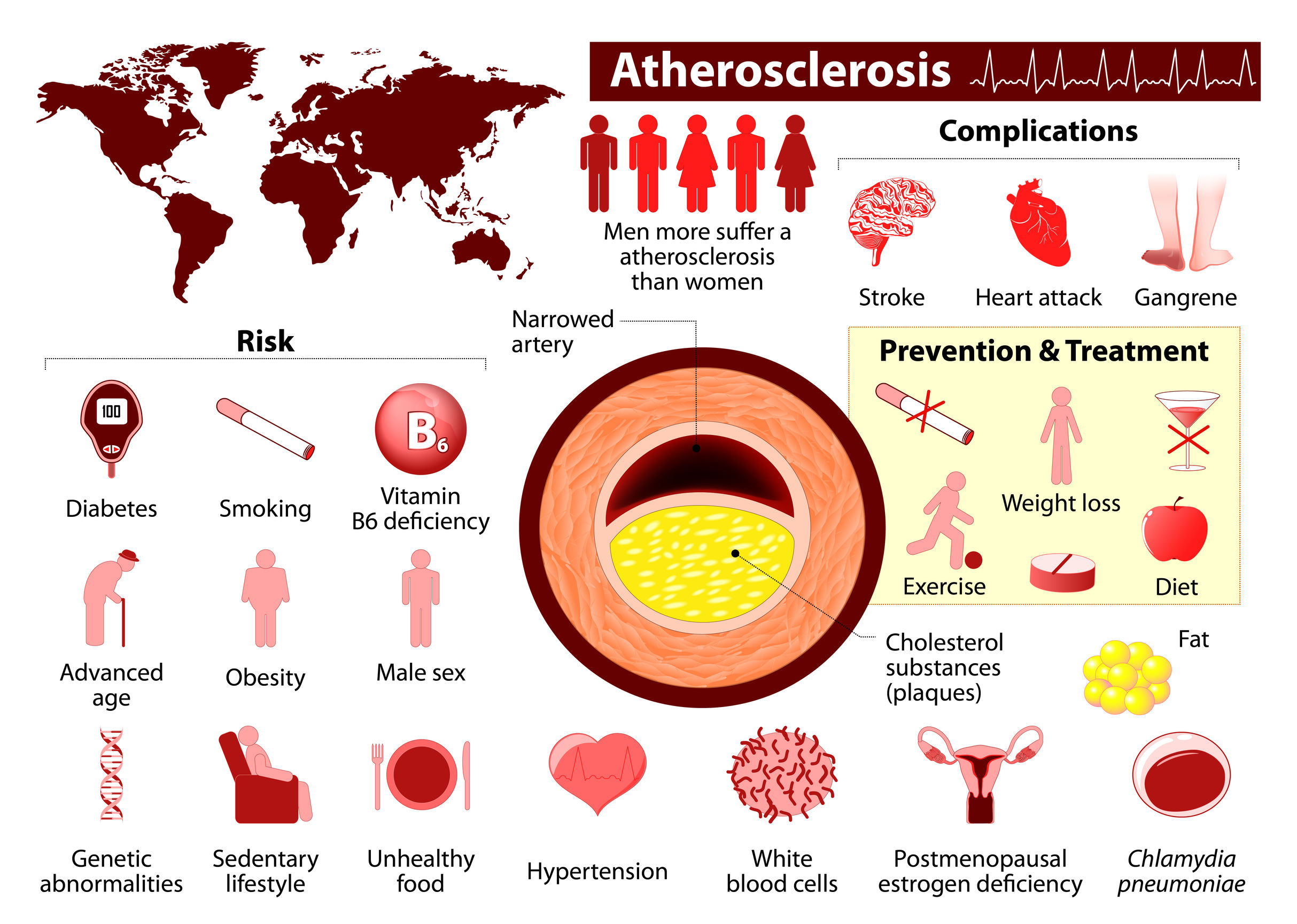 Atherosclerosis